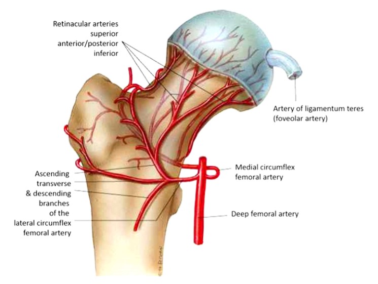 Femoral Intramedullary Nailing - How To Choose The Best Insertion Point Femoral Intramedullary Nailing - Paano Pumili Ang Pinakamagandang Insertion Point