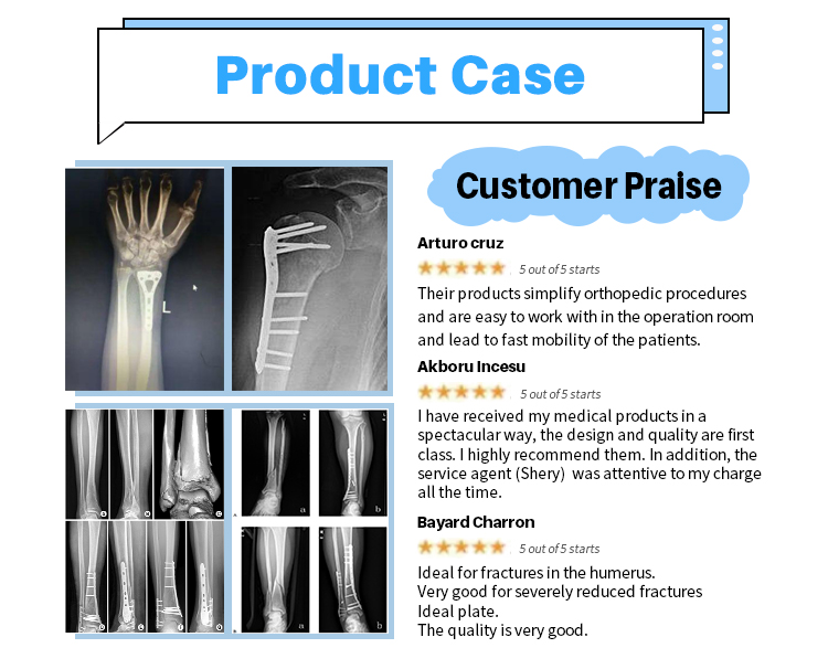 Clavicle-Claw-Locking-Plate_04 Ключица-нокът-фиксираща-плоча_04