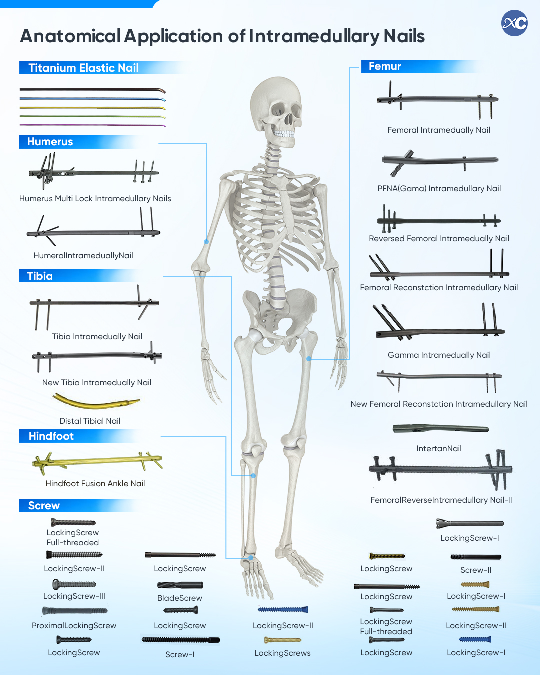 XC Medico intramedullary nail system for orthopedic distributors XC Medico intramedullary nail system para sa orthopedic distributors