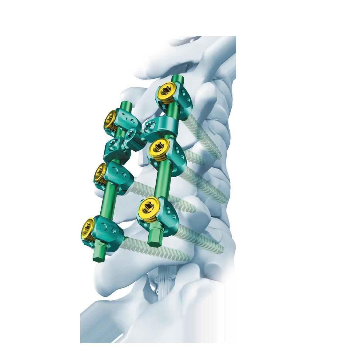 आम्हाला का निवडा