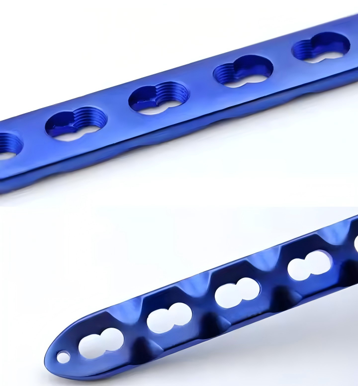 Ploča za zaključavanje ulne i radijusa-1