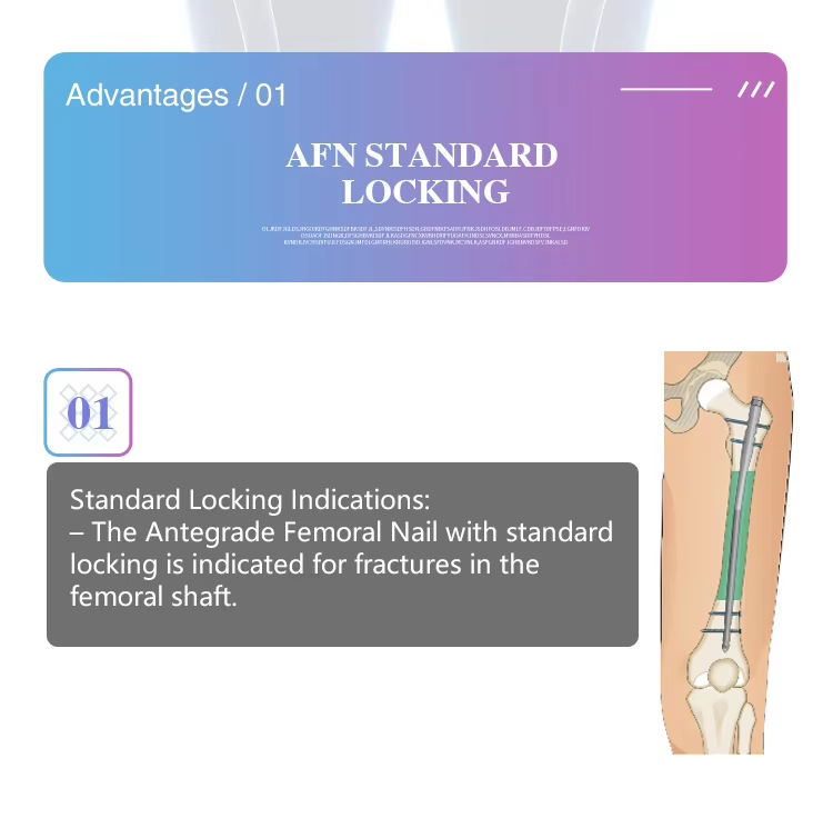 At&oacute;g&aacute;il Femoral Intramedullary ingne-2