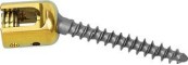 6.0 Iliac pedikle nurbaty