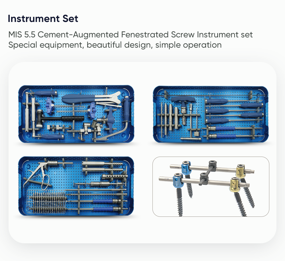 MIS 5.5 Zement-augment&eacute;iert fenestr&eacute;iert Schraube