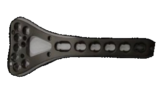 Distale Radius-Verriegelungsplatte (7 L&ouml;cher)