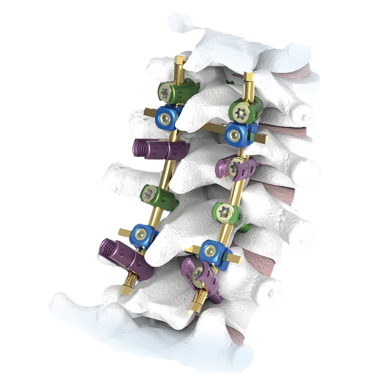 सर्वसमावेशक स्पाइनल पोर्टफोलिओ