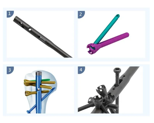 Humerus Multi Lock Intramedullary Nail-3