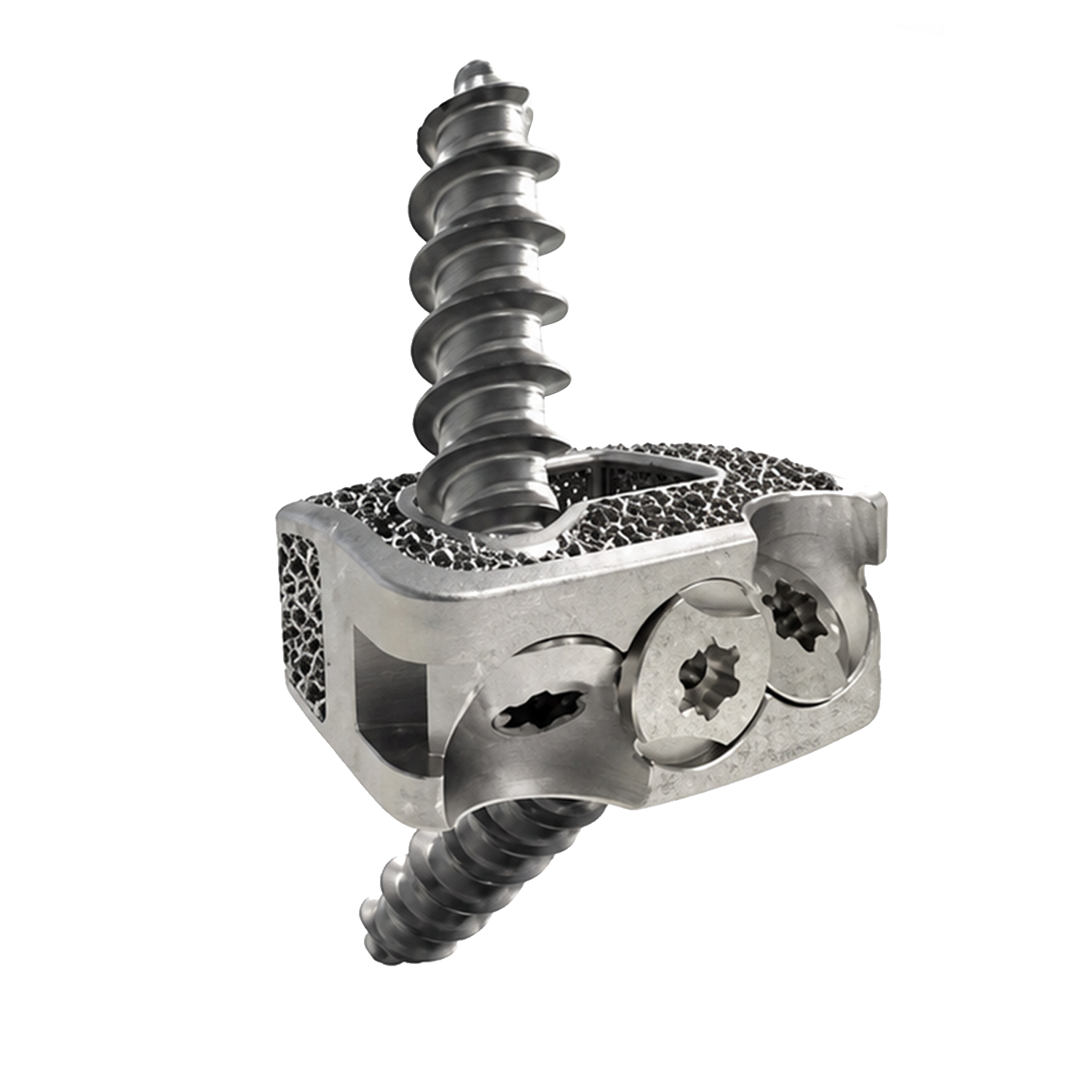 3D-impreso s&aacute;ndwich cervical intercuerpo fusi&oacute;n jaula