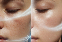 //a3.ldycdn.com/cloud/plBpjKqlllSRplkkijlliq/Oxygen-Optimization-Skin-Transformation.jpg